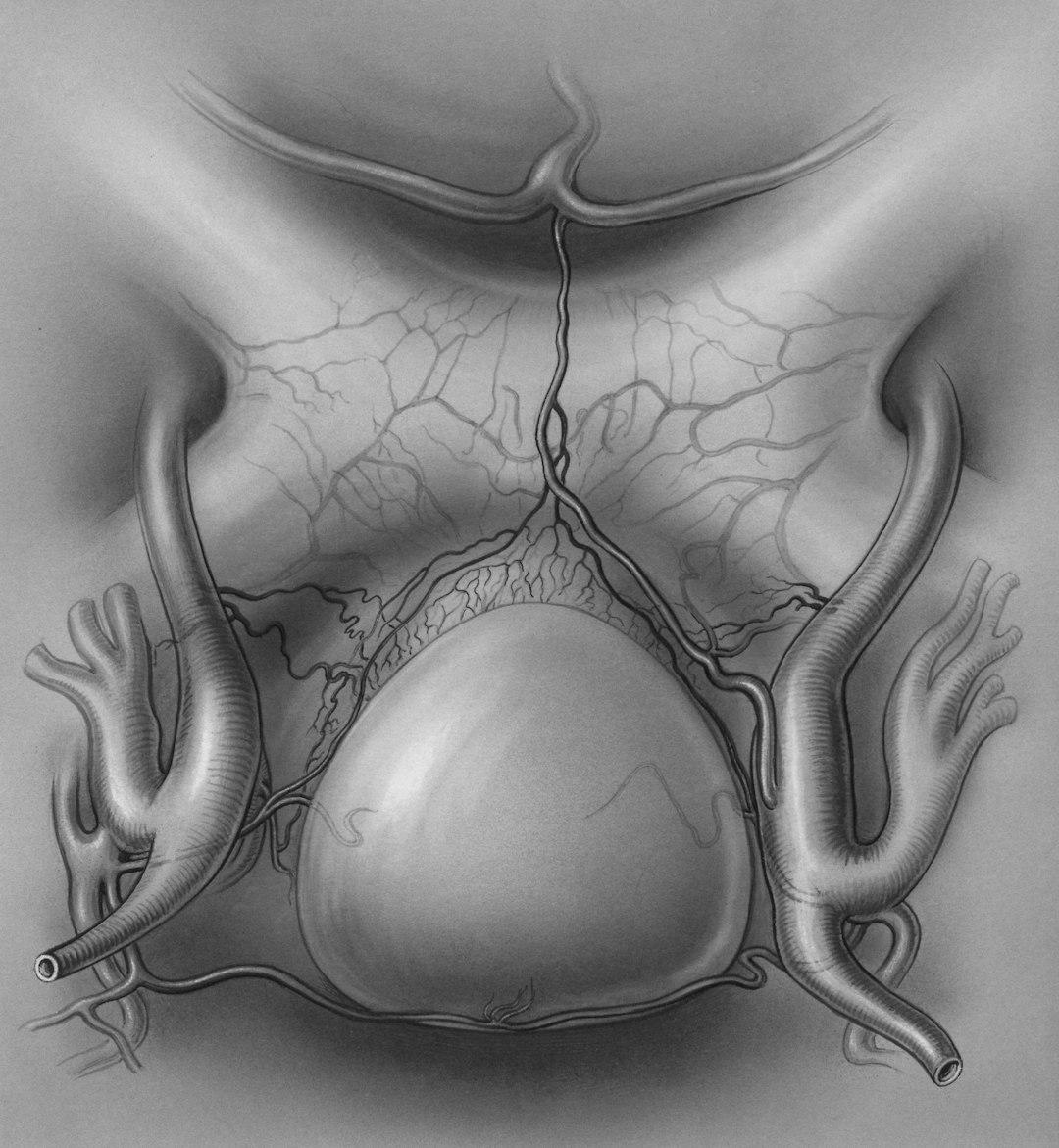 Promising Early Trial Of New Drug Offers Hope For 190 Million Endometriosis Patients