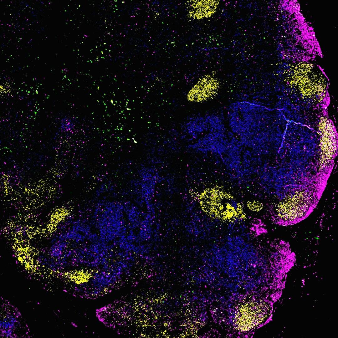 AI Tool Unifies Fragmented Cell Maps into Comprehensive Spatial Atlases