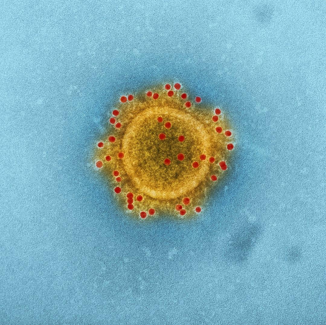 No Vaccine for Deadly Hantavirus: Implications for Future Outbreaks